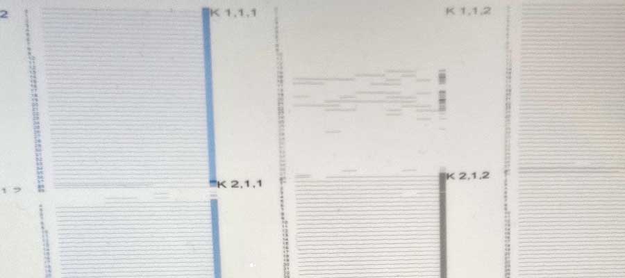 Why Is My DTF Printer Producing an Inconsistent Nozzle Check?
